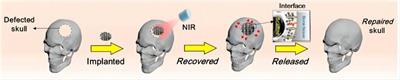 Unlocking the potential of stimuli-responsive biomaterials for bone regeneration